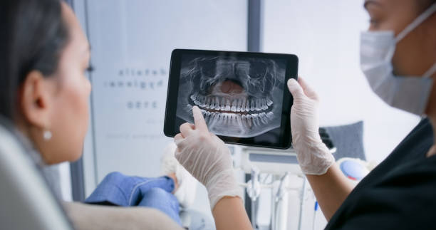 Licensed Tooth Extraction service in Johnson City, TN - Smile Center Dentistry